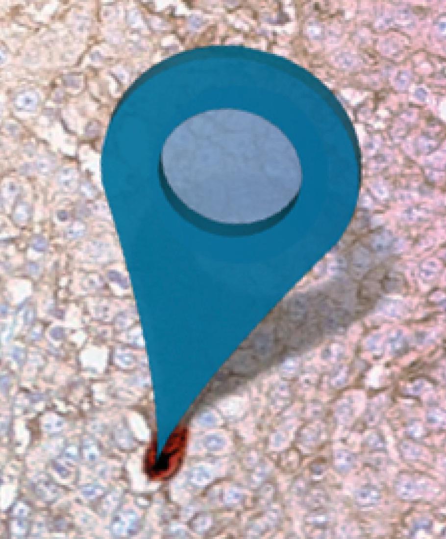 Kachelbild Präzisionsmedizin Unterseite Was ist ein Biomarker?